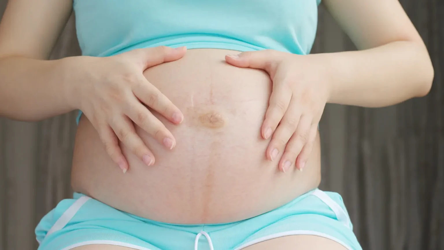 Mujer embarazada hidratándose — hábitos para prevenir las estrías del embarazo- clinica de dermatologia robotica