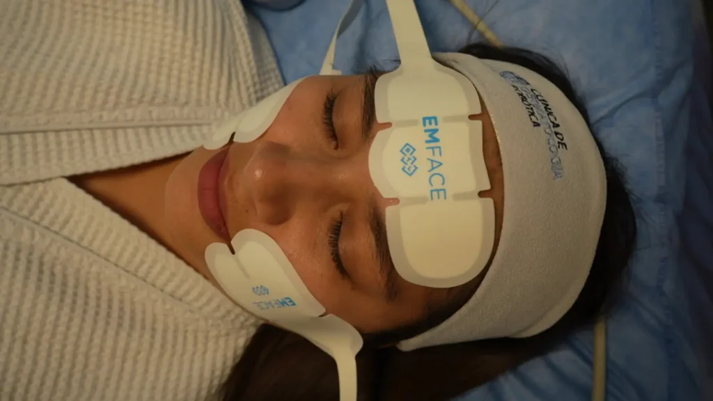 Sesión real con la tecnología EMFACE en rostro femenino (2)