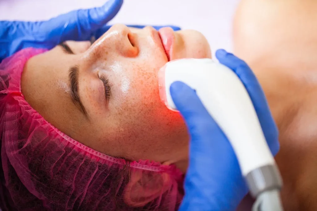 Tratamiento-de-acne-robotico-clinica-de-dermatologia-robotica-scaled