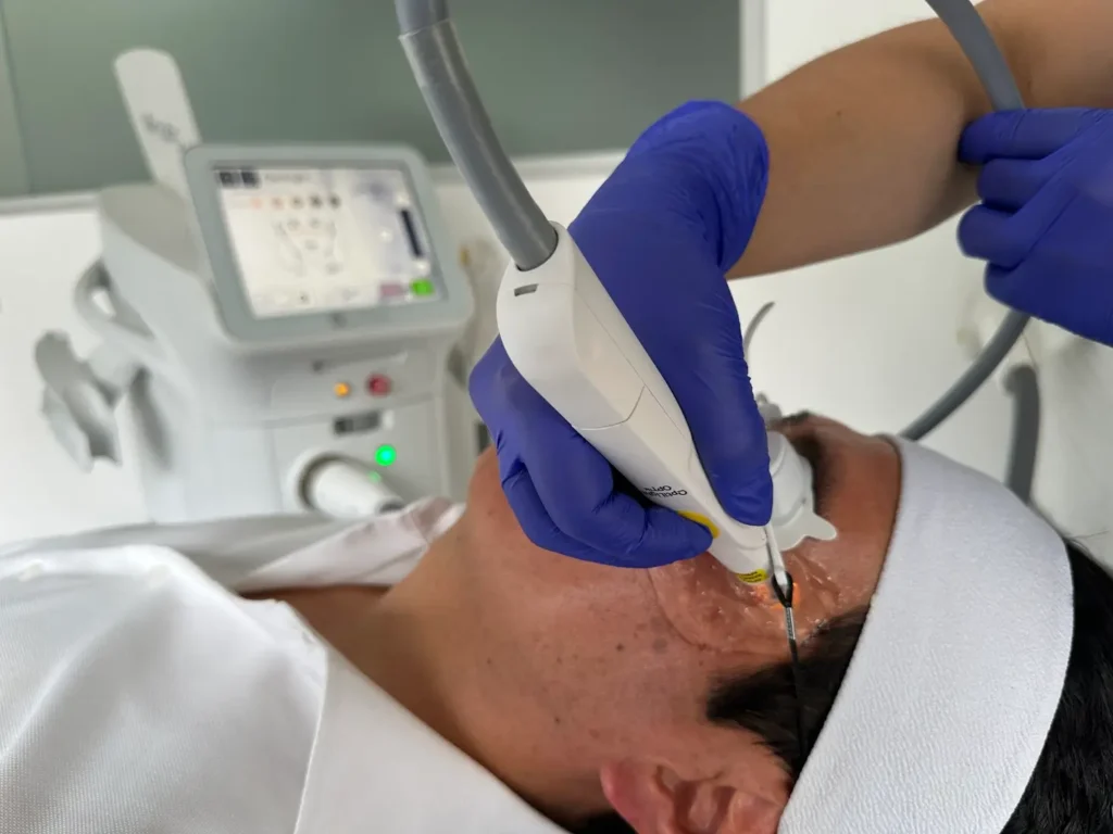 aplicacion optilight para ojo rojo