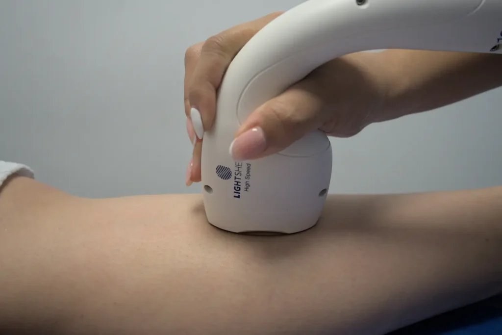 depilacion-laser-LIGHTSHEER®