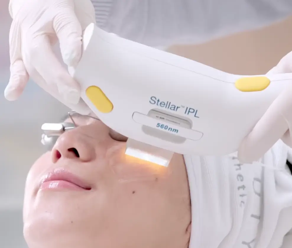 stellar m22 clinica de dermatologia robotica