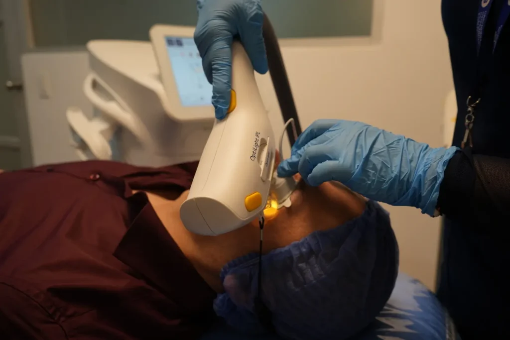 tratamiento optilight para ojo rojo