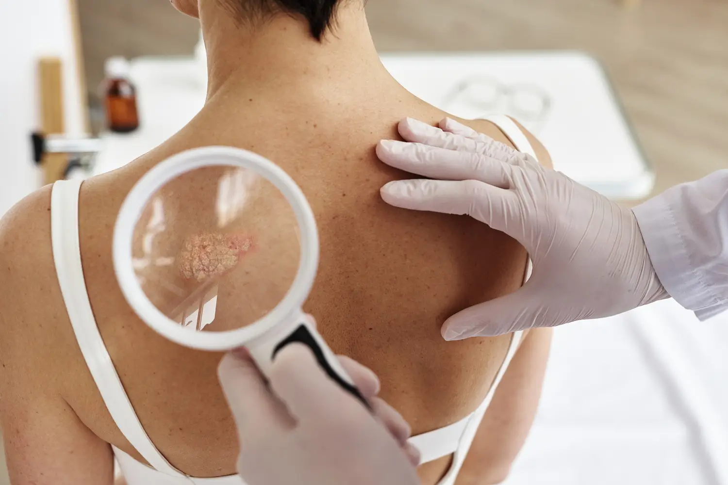 Dermatólogo revisando manchas de sol en la espalda de un paciente
