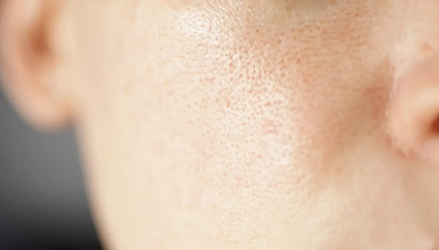 Blog dermatología robótica | Clínica de Dermatología Robótica Ilustración del funcionamiento de los poros en la piel del rostro- clinica de dermatología robótica
