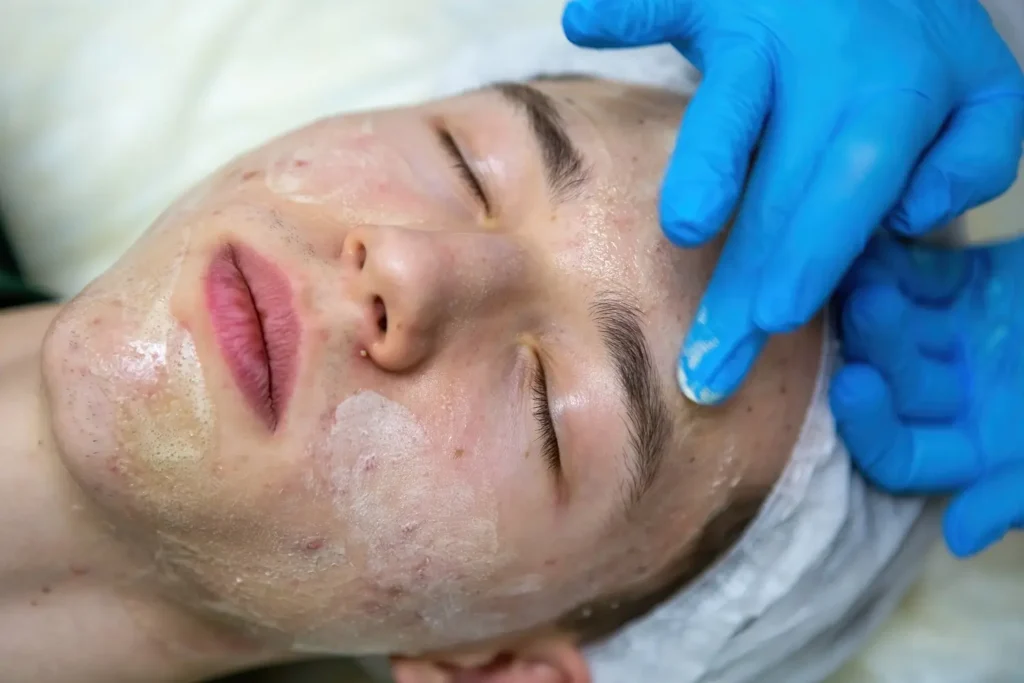 Rutina de limpieza facial para prevenir poros abiertos cara- clinica de dermatología robótica