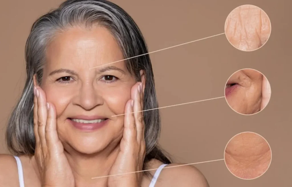 Diferentes tipos de arrugas según la edad – arrugas según la edad - clinica de dermatologia robótica