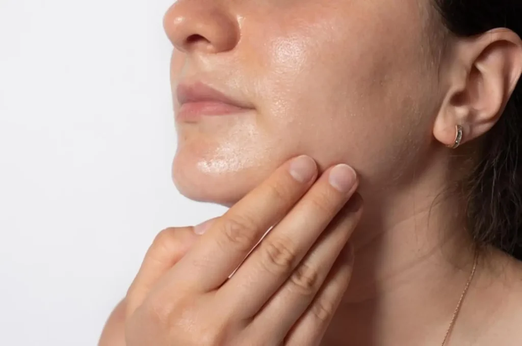 la piel grasa - clinica de dermatologia robótica