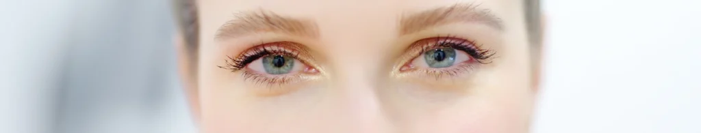 Imagen del contorno de ojos con ojeras oscuras antes del tratamiento - clinica de dermatologia robotica