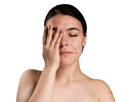 Manchas-de-piel-en-la-cara-clinica-de-dermatologia-robotica